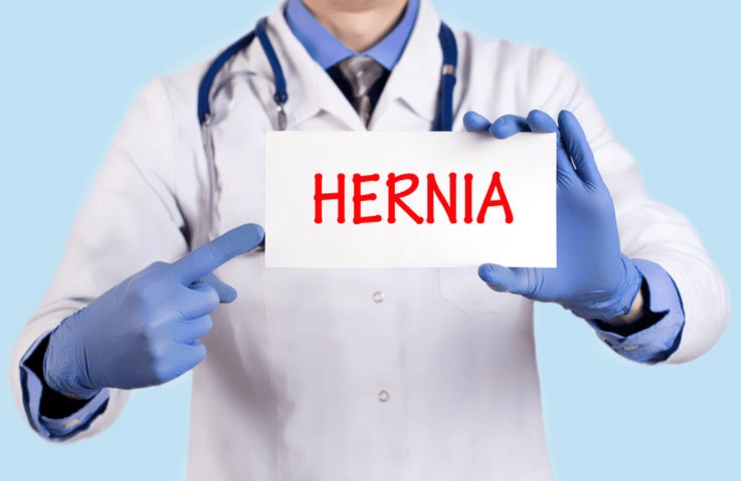 Beyond The Bulge: Your Guide to Understanding Hernia and its Surgical Management